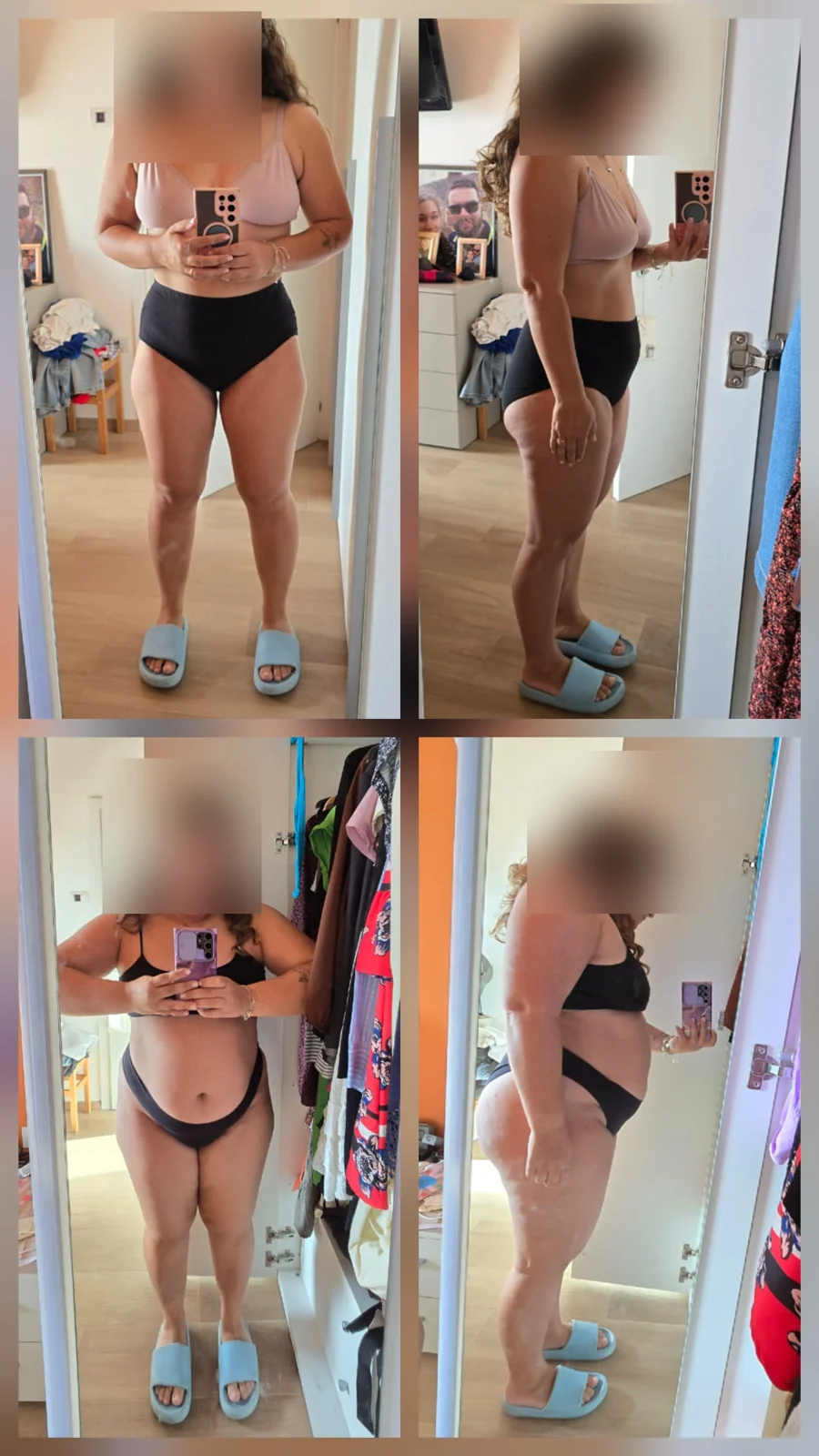 Antes e depois de paciente